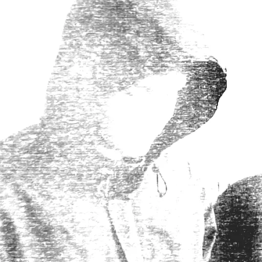 Hyas