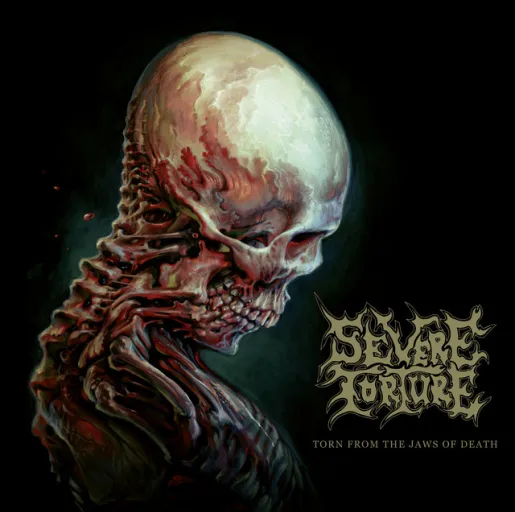 Severe Torture